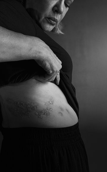 co to za choroba mobile