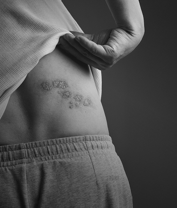 jak sie chronic mobile