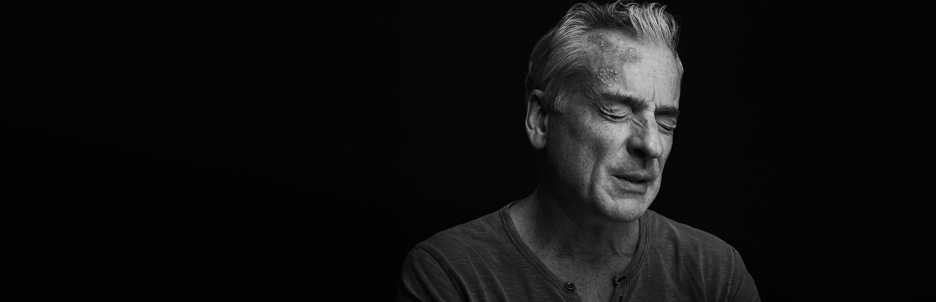 możliwe postacie półpaścia