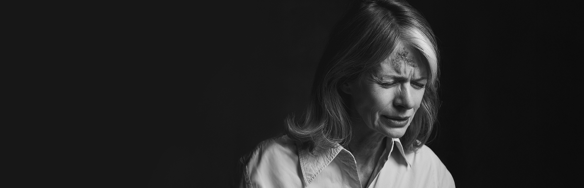 neuralgia polpascowa